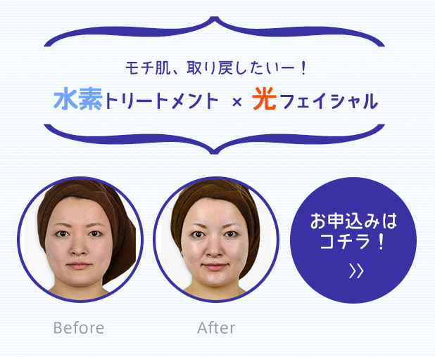 Blog_suiso